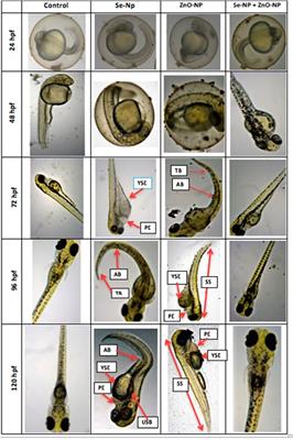 Selenium and Zinc Oxide Multinutrient Supplementation Enhanced Growth Performance in Zebra Fish by Modulating Oxidative Stress and Growth-Related Gene Expression